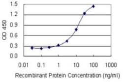 HDHD1A Antibody (4F12), Novus Biologicals 0.1 mg | Buy Online | Novus Biologicals | Fisher Scientific
