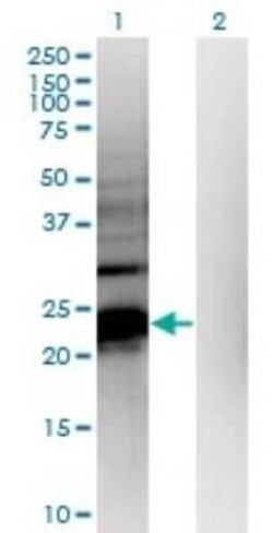 HDHD1A Antibody (4F12), Novus Biologicals 0.1 mg | Buy Online | Novus Biologicals | Fisher Scientific