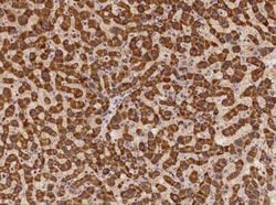 HDLBP Antibody, Novus Biologicals:Antibodies:Primary Antibodies