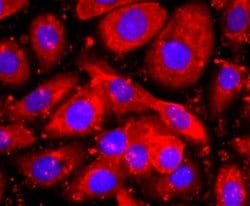HE4/WFDC2 Antibody (JF62-09), Novus Biologicals 100&mu;L:Antibodies, Monoclonal