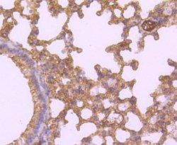 HE4/WFDC2 Antibody (JF62-09), Novus Biologicals 100&mu;L:Antibodies, Monoclonal