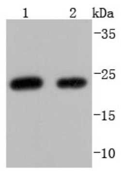 HE4/WFDC2 Antibody (JF62-09), Novus Biologicals 100&mu;L:Antibodies, Monoclonal