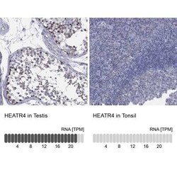 HEATR4 Rabbit anti-Human, Polyclonal, Novus Biologicals:Antibodies:Primary