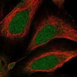 HEATR7A Rabbit anti-Human, Polyclonal, Novus Biologicals 25 &mu;g | Buy Online | Novus Biologicals | Fisher Scientific