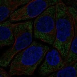 HECA Rabbit anti-Human, Polyclonal, Novus Biologicals 100 &mu;g | Buy Online | Bio-Techne | Fisher Scientific