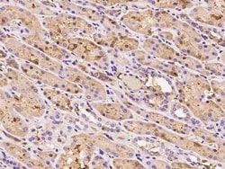 HEMK1 Antibody, Novus Biologicals:Antibodies:Primary Antibodies