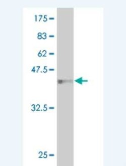 Novus Biologicals HEMK2 Antibody (1C4), Novus Biologicals 0.1 mg | Buy Online | Novus Biologicals&trade; | Fisher Scientific