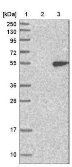 HENMT1 Antibody, Novus Biologicals 25 &mu;L; Unconjugated:Antibodies, Polyclonal