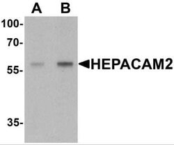 HEPACAM2 Antibody - BSA Free, Novus Biologicals 0.1 mg; Unconjugated:Antibodies,