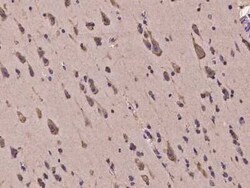 HERC2 Antibody, Novus Biologicals 50 &mu;g, Unconjugated:Antibodies, Polyclonal
