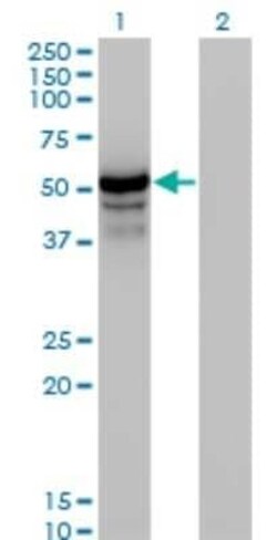 HERPUD1 Antibody (2G7), Novus Biologicals 0.1 mg, Unconjugated:Antibodies,