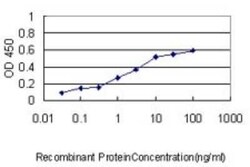 HERPUD1 Antibody (3E10), Novus Biologicals 0.1 mg | Buy Online | Novus Biologicals | Fisher Scientific