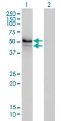 HERPUD1 Antibody (3E10), Novus Biologicals 0.1 mg | Buy Online | Novus Biologicals | Fisher Scientific