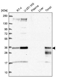 HES-1 Antibody, Novus Biologicals 100 &mu;g; Unconjugated:Antibodies, Polyclonal