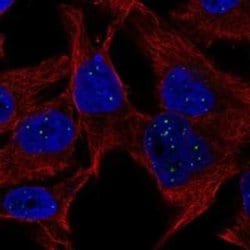 HES6 Rabbit anti-Human, Polyclonal, Novus Biologicals 25 &mu;g; Unconjugated:Antibodies,