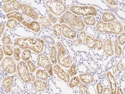 HEXB Antibody, Novus Biologicals 50 &mu;g; Unconjugated:Antibodies, Polyclonal