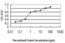 HFE Antibody (1G12), Novus Biologicals 0.1 mg; Unconjugated:Anticuerpos
