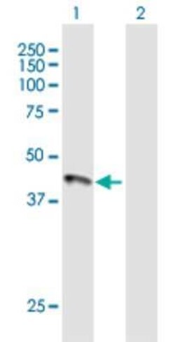 HFE Antibody, Novus Biologicals 0.05 mg | Buy Online | Novus Biologicals | Fisher Scientific