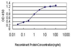 Novus Biologicals HGK/MAP4K4 Antibody (2D4), Novus Biologicals 0.1 mg | Buy Online | Novus Biologicals&trade; | Fisher Scientific