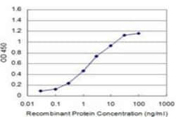 HGK/MAP4K4 Antibody (4F8), Novus Biologicals 0.1 mg | Buy Online | Novus Biologicals | Fisher Scientific