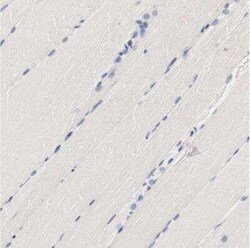 HGS Antibody, Novus Biologicals 25 &mu;L; Unconjugated:Antibodies, Polyclonal