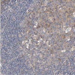 HGS Antibody, Novus Biologicals 25 &mu;L; Unconjugated:Antibodies, Polyclonal