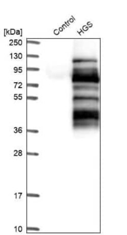 HGS Antibody, Novus Biologicals 25 &mu;L; Unconjugated:Antibodies, Polyclonal