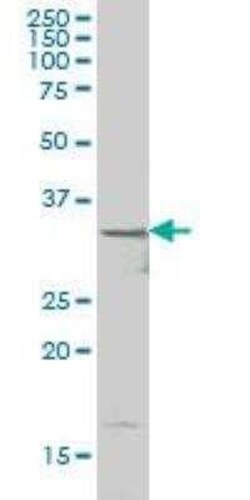 HHEX Antibody (1A5), Novus Biologicals 0.1 mg | Buy Online | Novus Biologicals | Fisher Scientific