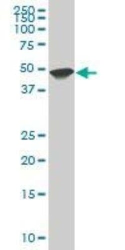 HHEX Antibody (1A5), Novus Biologicals 0.1 mg | Buy Online | Novus Biologicals | Fisher Scientific