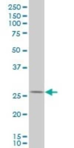 HHEX Antibody (2C8), Novus Biologicals 0.1 mg | Buy Online | Novus Biologicals | Fisher Scientific