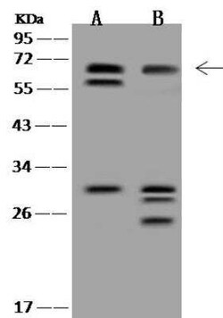HHMJG Antibody, Novus Biologicals 100 &mu;g; Unconjugated:Antibodies, Polyclonal