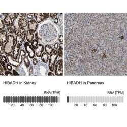 HIBADH Antibody, Novus Biologicals 0.1 mL | Buy Online | Novus Biologicals | Fisher Scientific