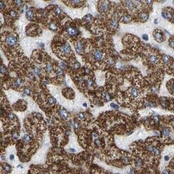 HIBADH Antibody, Novus Biologicals 0.1 mL | Buy Online | Novus Biologicals | Fisher Scientific