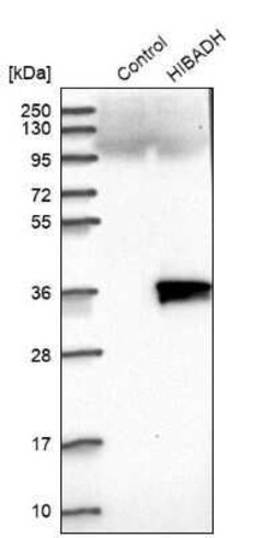 HIBADH Antibody, Novus Biologicals 0.1 mL | Buy Online | Novus Biologicals | Fisher Scientific