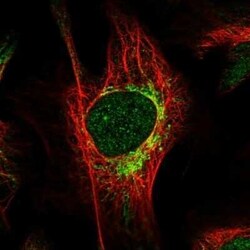 HIBCH Antibody, Novus Biologicals 0.1 mL; Unconjugated:Antibodies, Polyclonal