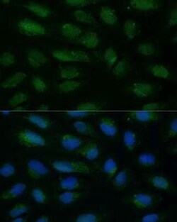 HIBCH Rabbit anti-Human, Mouse, Rat, Polyclonal, Novus Biologicals 20 &mu;g | Buy Online | Bio-Techne | Fisher Scientific