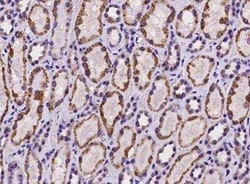 HIBCH Antibody, Novus Biologicals:Antibodies:Primary Antibodies
