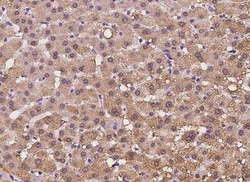 HIBCH Antibody, Novus Biologicals:Antibodies:Primary Antibodies