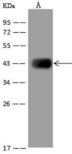 HIBCH Antibody, Novus Biologicals:Antibodies:Primary Antibodies
