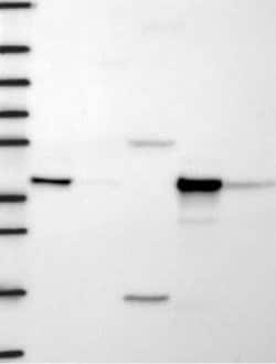 HIBCH Rabbit anti-Human, Polyclonal, Novus Biologicals 100 &mu;g; Unconjugated:Antibodies,