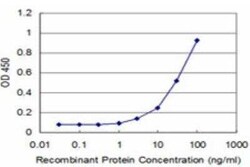 HIC1 Antibody (1E11), Novus Biologicals 0.1 mg | Buy Online | Novus Biologicals | Fisher Scientific