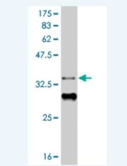 Novus Biologicals HIC1 Antibody (1F2), Novus Biologicals 0.1 mg | Buy Online | Novus Biologicals&trade; | Fisher Scientific