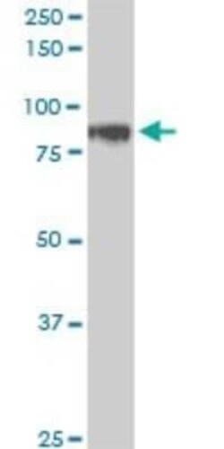 HIC1 Antibody (4E11), Novus Biologicals 0.1 mg | Buy Online | Novus Biologicals | Fisher Scientific