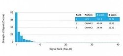 HIC2 Mouse anti-Human, Clone: PCRP-HIC2-1B1, Novus Biologicals:Antibodies:Primary
