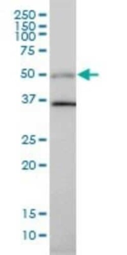 HIC5/TGFB1I1 Antibody (4B2-D8), Novus Biologicals 0.1 mg, Unconjugated:Antibodies,