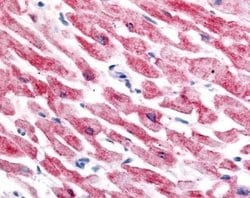 HIF-2 alpha/EPAS1 Antibody (ep190b) - Azide and BSA Free, Novus Biologicals