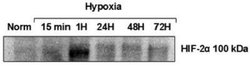 HIF-2 alpha/EPAS1 Antibody (ep190b) - Azide and BSA Free, Novus Biologicals