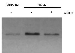 HIF-2 alpha/EPAS1 Antibody (ep190b) - Azide and BSA Free, Novus Biologicals