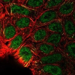HIF-2 alpha/EPAS1 Antibody, Novus Biologicals:Antibodies:Primary Antibodies