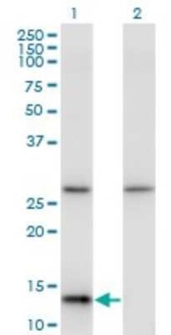 HINT1 Antibody (2D7), Novus Biologicals 0.1 mg, Unconjugated:Antibodies,
